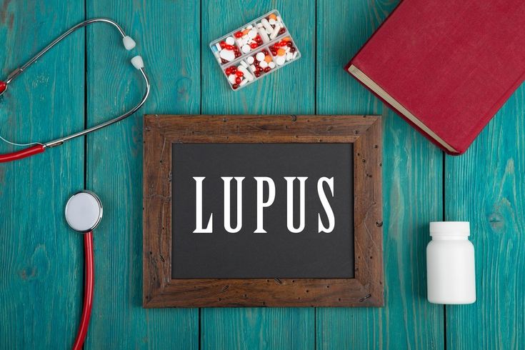 Lupus